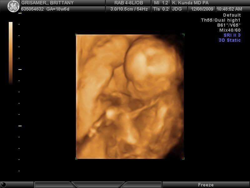 19 weeks 3D ultrasound!!!! - JustMommies Message Boards